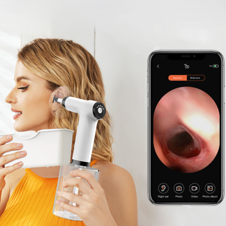 IRYGATOR DO CZYSZCZENIA USZU NV300 IRYGATOR DO CZYSZCZENIA USZU NV300