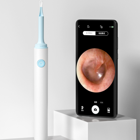 KAMERA DO CZYSZCZENIA USZU NV100 KAMERA DO CZYSZCZENIA USZU NV100