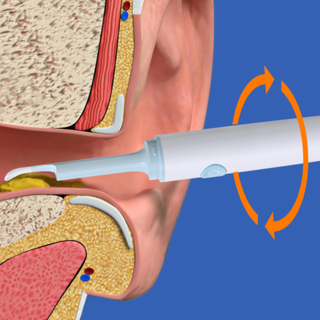KAMERA DO CZYSZCZENIA USZU NV100 KAMERA DO CZYSZCZENIA USZU NV100