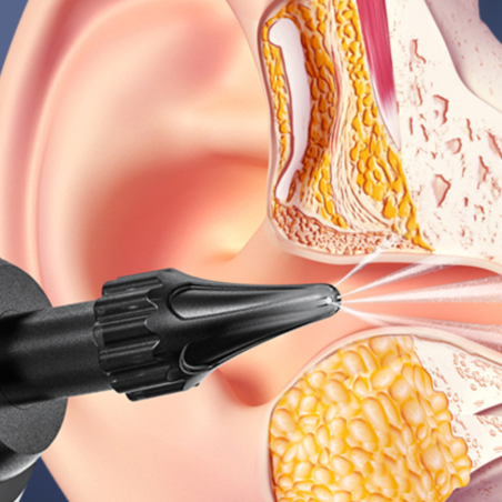 IRYGATOR DO USZU NV350 IRYGATOR DO USZU NV350