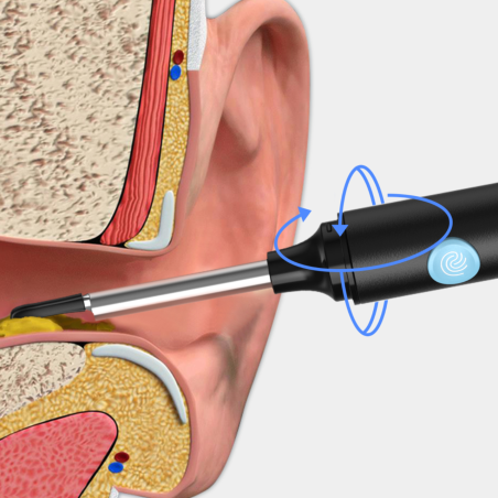 IRYGATOR DO USZU NV140 IRYGATOR DO USZU NV140